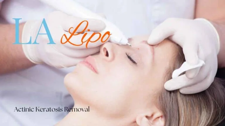Woman receiving Actinic Keratosis Removal Treatment Cannock