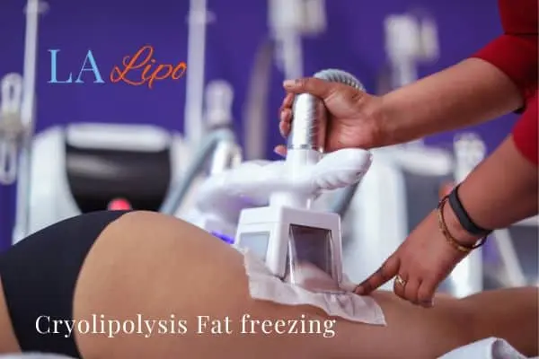 women getting fat freezing Cannock