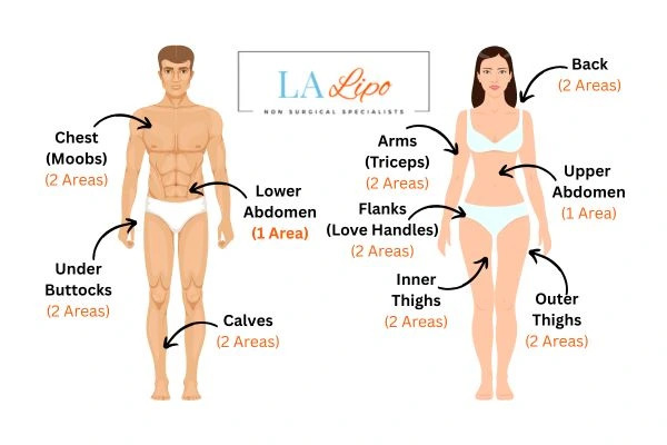 LA LIPO Cryolipolysis Areas Cannock
