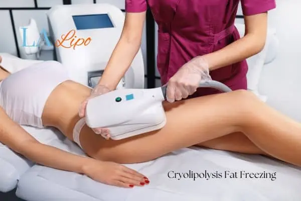 Woman receiving coolsculpting Cannock treatment on her thighs