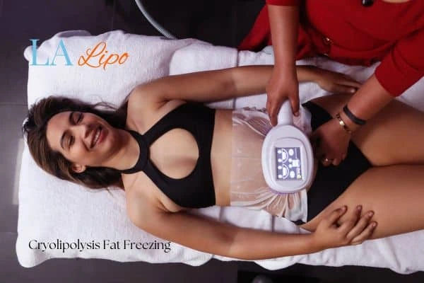 woman getting cryolipolysis Cannock