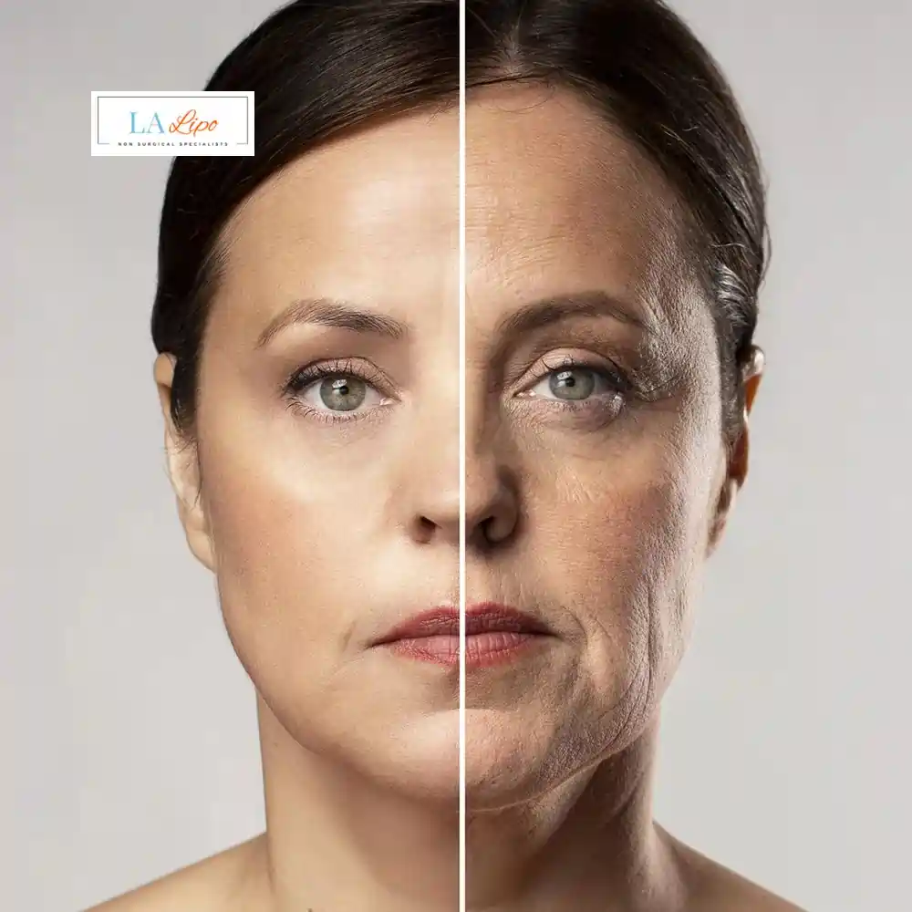 How Can You Tell If Non-Surgical Skin Tightening Is Right for You Cannock?