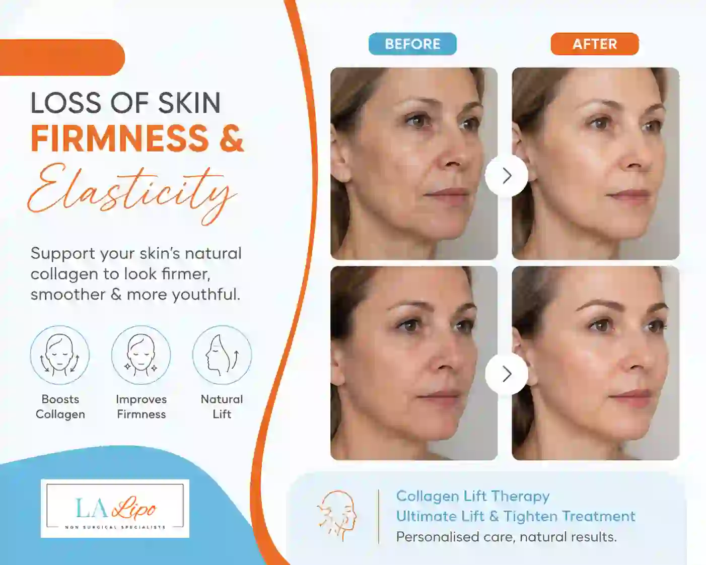 Sign #7: Loss of Skin Firmness and Elasticity Cannock